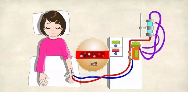 血透病人如何保护好&ldquo;生命线&rdquo;