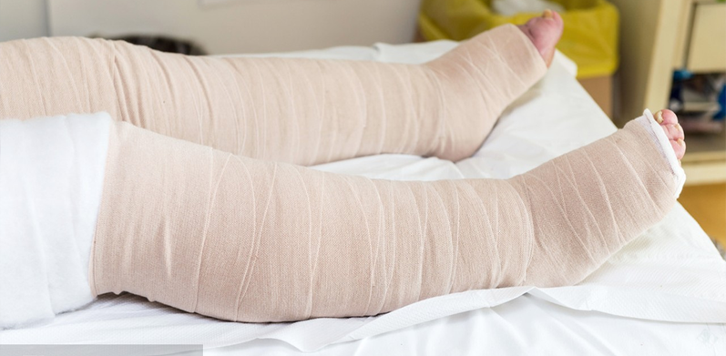 下肢水肿，原因有哪些