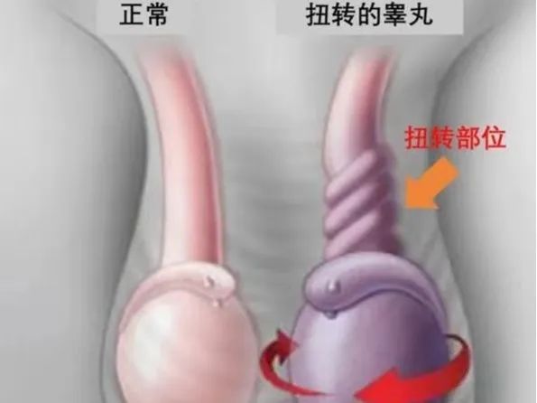 &ldquo;蛋疼&rdquo;无小事，家有男娃需注意！