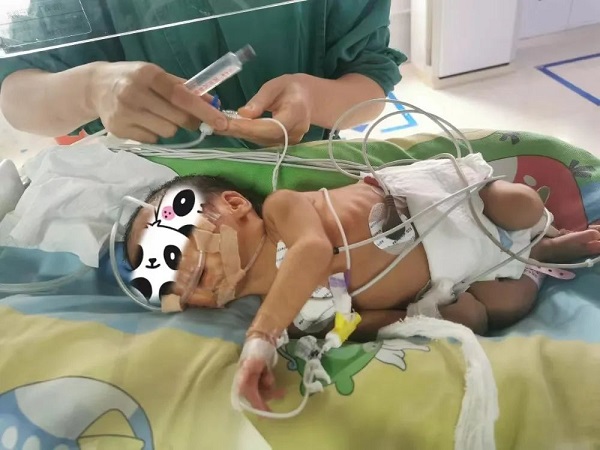 早产&ldquo;宝&rdquo;卫战！我院NICU成功救治30⁺&sup2;周早产儿！