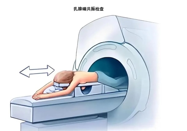 乳腺磁共振，精准守护乳腺健康
